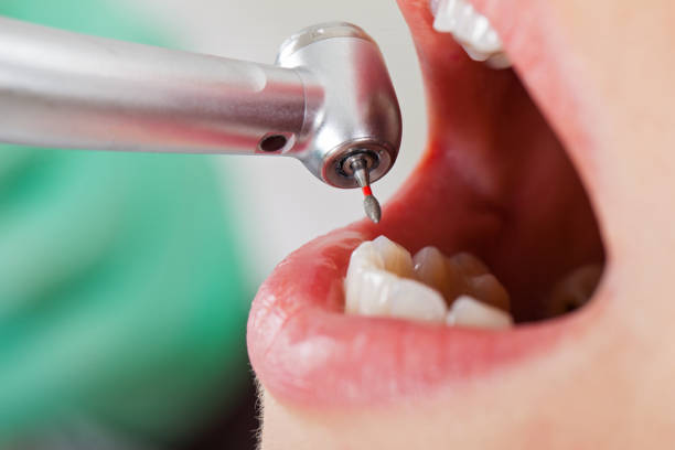 Best Pediatric Emergency Dentist in Nazareth College, NY